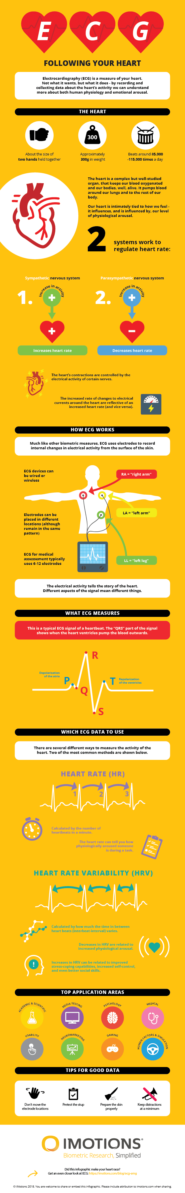 ECG infographic
